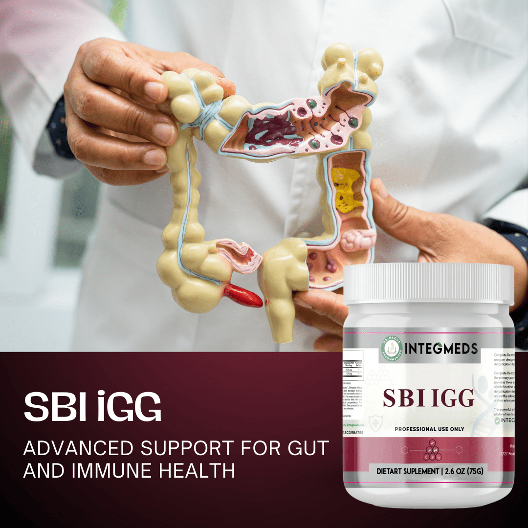 SBI iGG - Image 4